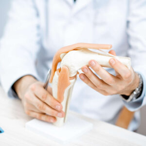 Knee model explaim